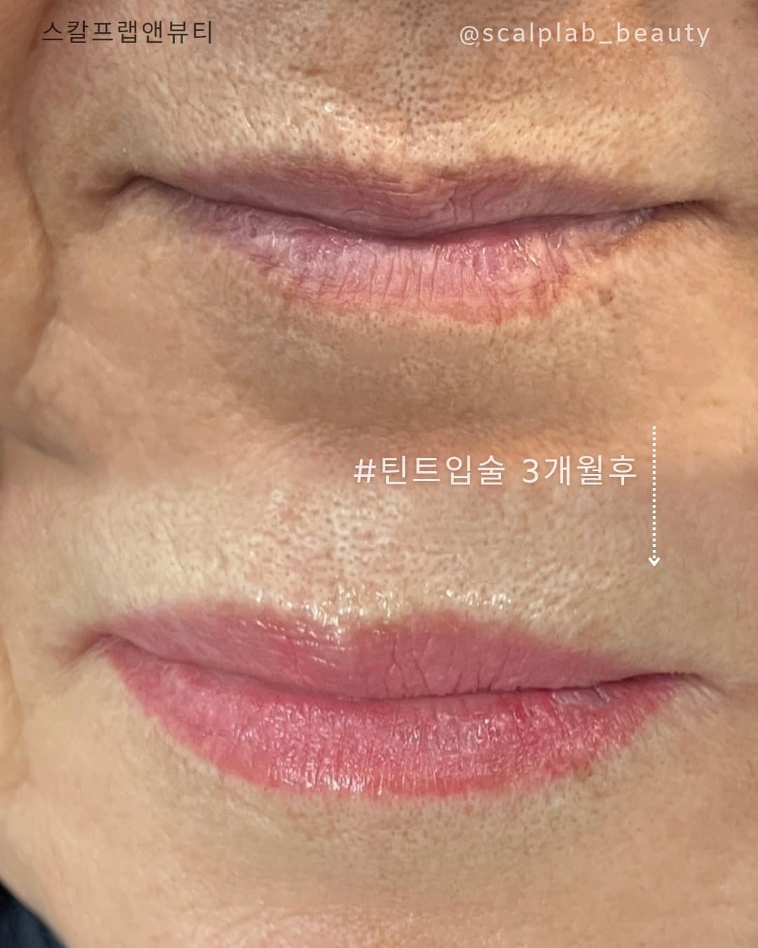 틴트입술 3개월 후